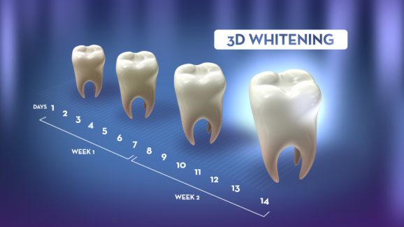 ORAL_B_3D_WHITENING (00734)