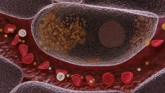 Epanova FINAL clean FULL HD (01749)