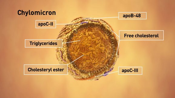 Epanova FINAL clean FULL HD (02176)
